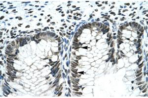 Rabbit Anti-GLI2 Antibody  Paraffin Embedded Tissue: Human Intestine Cellular Data: Epithelial cells of intestinal gland Antibody Concentration: 4. (GLI2 antibody  (Middle Region))