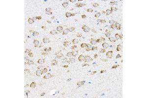 Immunohistochemistry of paraffin-embedded mouse brain using RPL4 Rabbit pAb (ABIN6129106, ABIN6147145, ABIN6147146 and ABIN6221591) at dilution of 1:100 (40x lens). (RPL4 antibody  (AA 1-240))