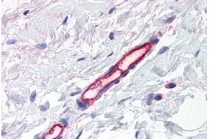 Human Breast, Vessels (formalin-fixed, paraffin-embedded) stained with PLXDC1 antibody ABIN337391 at 2. (PLXDC1 antibody  (AA 411-427))