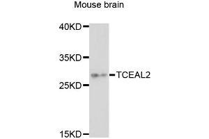 Western blot analysis of extracts of mouse brain, using TCEAL2 antibody (ABIN6293088) at 1:3000 dilution.