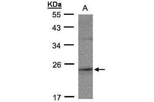 WB Image Sample(30 ug whole cell lysate) A:MOLT4 , 12% SDS PAGE antibody diluted at 1:500 (RAP2C antibody)