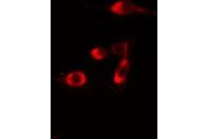 ABIN6275708 staining  Hela cells by IF/ICC. (RAD51C antibody  (Internal Region))