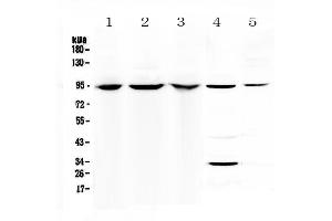 Western blot analysis of Complement C7 using anti-Complement C7 antibody .