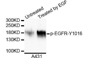 Western blot analysis of extracts of various cell lines, using Phospho-EGFR-Y1016 antibody. (EGFR antibody  (pTyr992))