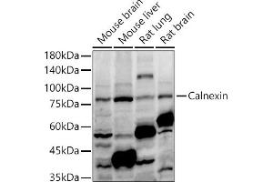 Western blot analysis of extracts of various cell lines, using Calnexin antibody (ABIN7266031) at 1:1000 dilution. (Calnexin antibody  (AA 501-592))