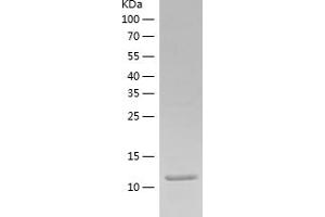 Chemokine (C-C Motif) Ligand 5 (CCL5) (AA 24-91) (Active) protein (His tag)