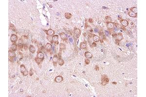 Formalin-fixed and paraffin embedded: rat brain tissue labeled with Anti-beta-Amyloid(1-42) Polyclonal Antibody (ABIN725015), Unconjugated 1:200 followed by conjugation to the secondary antibody and DAB staining (Abeta 1-42 antibody  (AA 1-42))