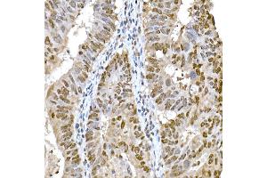 Immunohistochemistry (IHC) image for anti-SNAIL (SNAI1) (AA 1-100) antibody (ABIN1682836)