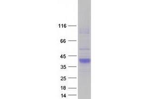 Validation with Western Blot (SCN3B Protein (Transcript Variant 2) (Myc-DYKDDDDK Tag))