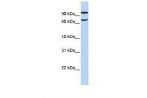 Image no. 1 for anti-Family with Sequence Similarity 38, Member B (FAM38B) (AA 2570-2619) antibody (ABIN6738595) (PIEZO2 antibody  (AA 2570-2619))