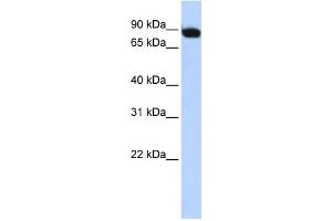 WB Suggested Anti-CREBL1 Antibody Titration: 0. (ATF6B antibody  (Middle Region))