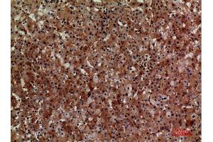 Immunohistochemistry (IHC) analysis of paraffin-embedded Human Liver, antibody was diluted at 1:100. (CD276 antibody  (Internal Region))