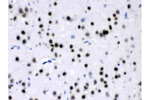Immunohistochemistry (IHC) image for anti-Myocyte Enhancer Factor 2A (MEF2A) (AA 466-507), (C-Term) antibody (ABIN4886665)