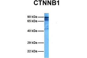 Host:  Rabbit  Target Name:  CTNNB1  Sample Tissue:  Human MCF7  Antibody Dilution:  1. (CTNNB1 antibody  (C-Term))