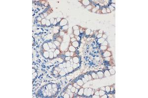 Immunohistochemistry of paraffin-embedded Human colon using CHDH Rabbit pAb (ABIN7266341) at dilution of 1:100 (40x lens). (CHDH antibody  (AA 245-594))