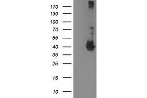 HEK293T cells were transfected with the pCMV6-ENTRY control (Left lane) or pCMV6-ENTRY MAPRE2 (Right lane) cDNA for 48 hrs and lysed. (MAPRE2 antibody)
