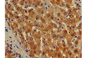 Immunohistochemistry of paraffin-embedded human liver tissue using ABIN7157050 at dilution of 1:100 (ISCA1 antibody  (AA 67-122))