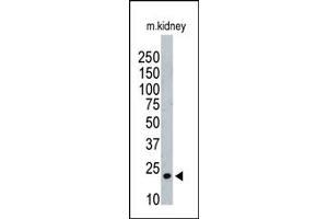 Image no. 1 for anti-ISG15 Ubiquitin-Like Modifier (ISG15) (AA 39-68), (N-Term) antibody (ABIN356679) (ISG15 antibody  (N-Term))