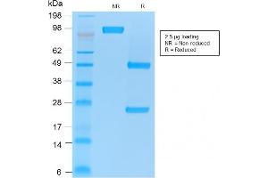 SDS-PAGE Analysis Purified CD86 Mouse Recombinant Monoclonal Antibody (rC86/1146). (Recombinant CD86 antibody)