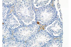 ABIN6264292 and ABIN6278946 at 1/100 staining Mouse testis tissue by IHC-P. (PLCH2 antibody  (N-Term))