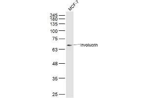 MCF7 lysates probed with Involucrin Polyclonal Antibody, Unconjugated  at 1:300 dilution and 4˚C overnight incubation. (Involucrin antibody  (AA 21-120))