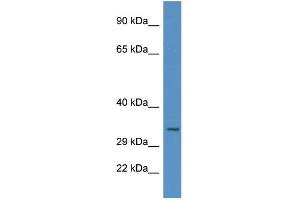 WB Suggested Anti-UNG AntibodyTitration: 1. (UNG antibody  (C-Term))