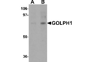 Western blot analysis of GOLPH1 in K562 cell lysate with GOLPH1 antibody at (A) 1 and (B) 2 µg/mL.