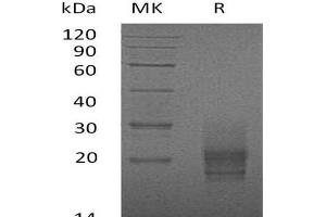 Western Blotting (WB) image for Colony Stimulating Factor 2 (Granulocyte-Macrophage) (CSF2) (Active) protein (His tag) (ABIN7320538) (GM-CSF Protein (His tag))