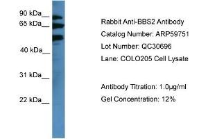WB Suggested Anti-BBS2  Antibody Titration: 0.