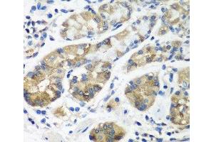 Immunohistochemistry of paraffin-embedded Human stomach using STX16 Polyclonal Antibody at dilution of 1:100 (40x lens). (Syntaxin 16 antibody)