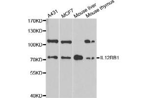 Western blot analysis of extracts of various cell lines, using IL12RB1 antibody. (IL12RB1 antibody)