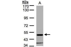 WB Image Sample(30 μg of whole cell lysate) A:HeLa S3, 7. (GLRA1 antibody)