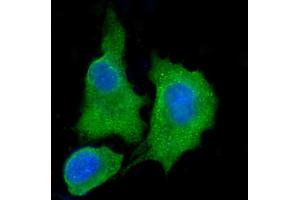 IF analysis of ALDH3A1 using anti-ALDH3A1 antibody (ABIN7601680). (ALDH3A1 antibody  (AA 413-453))
