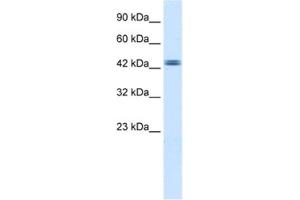 Western Blotting (WB) image for anti-tyrosyl-DNA phosphodiesterase 2 (TDP2) antibody (ABIN2460635) (TDP2 antibody)