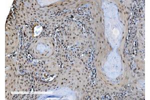 IHC analysis of DDX1 using anti-DDX1 antibody (ABIN7602051). (DDX1 antibody  (AA 562-740))