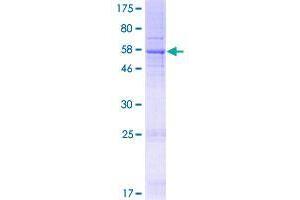 Image no. 1 for Transmembrane Protein 39B (TMEM39B) (AA 1-365) protein (GST tag) (ABIN1323021) (TMEM39B Protein (AA 1-365) (GST tag))