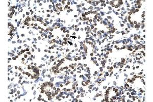 ZNF385 antibody was used for immunohistochemistry at a concentration of 4-8 ug/ml to stain Alveolar ceils (arrows) in Human Lung. (ZNF385A antibody  (N-Term))