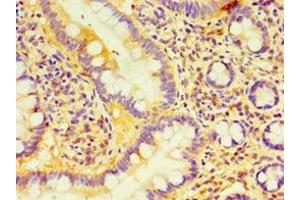 Immunohistochemistry of paraffin-embedded human small intestine tissue using ABIN7158861 at dilution of 1:100 (DCP2 antibody  (AA 1-240))