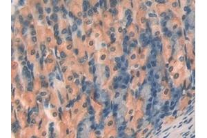 Detection of TBG in Mouse Stomach Tissue using Polyclonal Antibody to Thyroxine Binding Globulin (TBG) (SERPINA7 antibody  (AA 127-393))