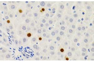 Immunohistochemistry of paraffin-embedded Rat liver using GEMIN2 Polyclonal Antibody at dilution of 1:200 (40x lens). (SIP1 antibody)