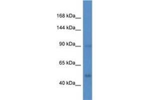 Image no. 1 for anti-Hypoxia Inducible Factor 1, alpha Subunit (Basic Helix-Loop-Helix Transcription Factor) (HIF1A) (N-Term) antibody (ABIN6746011)