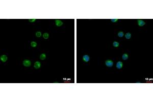 ICC/IF Image VPS37C antibody [N1], N-term detects VPS37C protein at cytoplasm by immunofluorescent analysis. (VPS37C antibody  (N-Term))