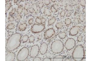 Immunoperoxidase of monoclonal antibody to HMGB1 on formalin-fixed paraffin-embedded human stomach. (HMGB1 antibody  (AA 1-215))