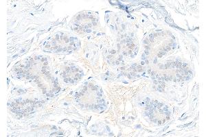 Immunohistochemistry (IHC) image for anti-Signal Transducer and Activator of Transcription 5B (STAT5B) (AA 737-787) antibody (ABIN7455110)