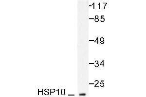 Image no. 1 for anti-Heat Shock 10kDa Protein 1 (Chaperonin 10) (HSPE1) antibody (ABIN265468) (HSPE1 antibody)