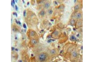 #VALUE! (F12 antibody  (AA 352-587))