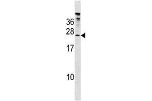 HTATSF1 antibody western blot analysis in 293 lysate. (HTATSF1 antibody  (AA 152-179))
