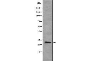 Western blot analysis of COPS8 using Jurkat whole cell lysates (COPS8 antibody  (Internal Region))