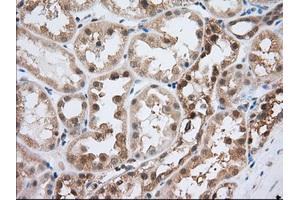 Image no. 9 for anti-Acetyl-CoA Acetyltransferase 2 (ACAT2) antibody (ABIN1496403) (ACAT2 antibody)