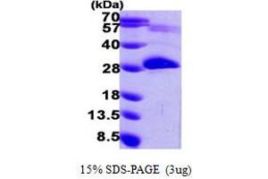 SDS-PAGE (SDS) image for Pyridoxamine 5'-Phosphate Oxidase (PNPO) (AA 57-261) protein (His tag) (ABIN667278)